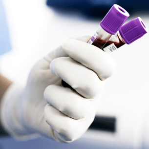 Immunoassay testing